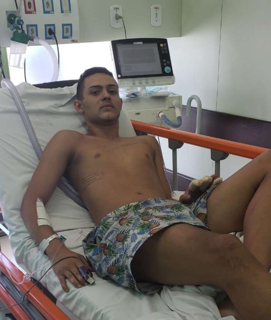 Caun deu sinais de melhoras após acidente. (Foto: Reprodução)