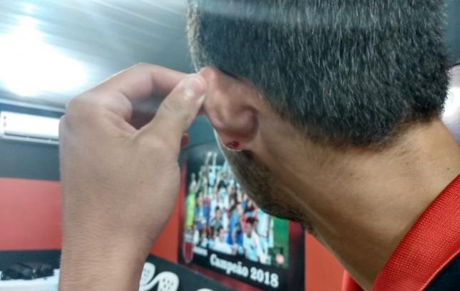 Emerson Bacas mostra orelha machucada — Foto: Reprodução