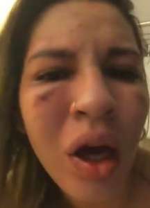 Com a cara inchada, esposa relata agressão de jogador do São Paulo