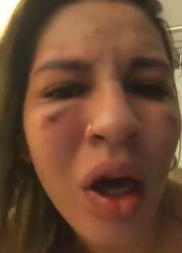 Com a cara inchada, esposa relata agressão de jogador do São Paulo