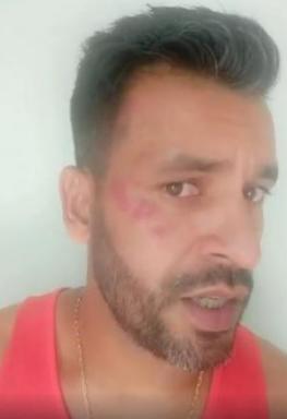 Glédson com o rosto vermelho após levar chute de Bruno Silva durante confusão (Foto: Reprodução/Instagram)