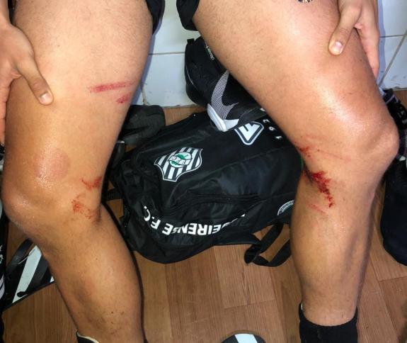 Geninho sobre lance polêmico do Avaí: “Pelo em ovo”; Lateral tem perna machucada