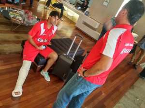Marcos, lateral do CRB, fratura a tíbia e está fora da Série B