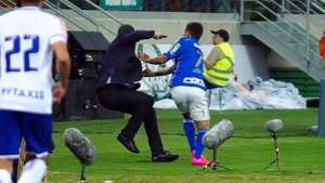 Luxemburgo fratura a mão após trombada com Dudu, do Palmeiras, e pode precisar de cirurgia