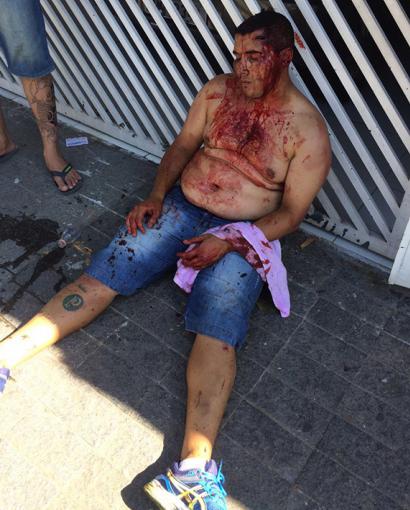 Este torcedor levou a pior na brigas entre torcidas nas ruas da capital pela manhã