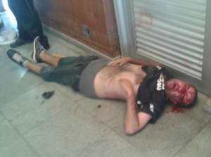 Agredido em briga no metrô, corintiano de torcida organizada está na UTI