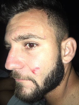 Paranaense: Atacante do Prudentópolis é assaltado e agredido nos arredores de estádio