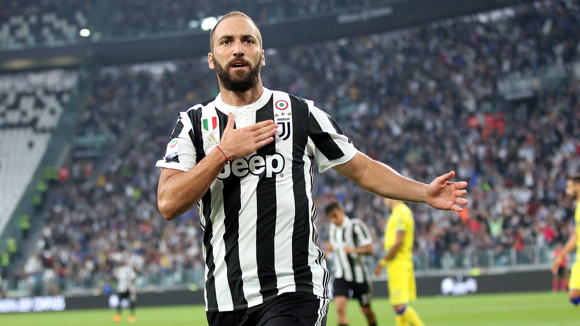 Italiano: Após fraturar a mão, Higuaín é relacionado e pode reforçar a Juventus na sexta