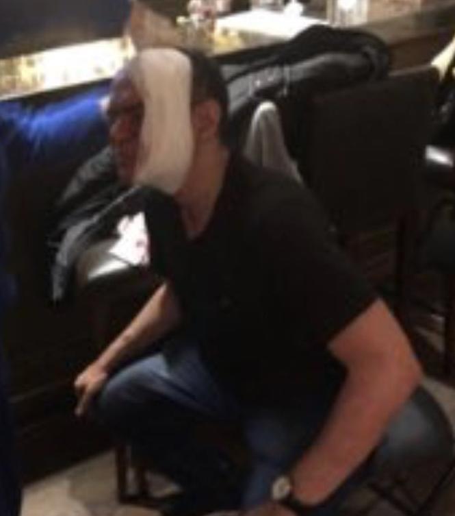 Alexandre Nazareno foi agredido por assessor da CBF. (Foto: Diuvlgação / Twitter)