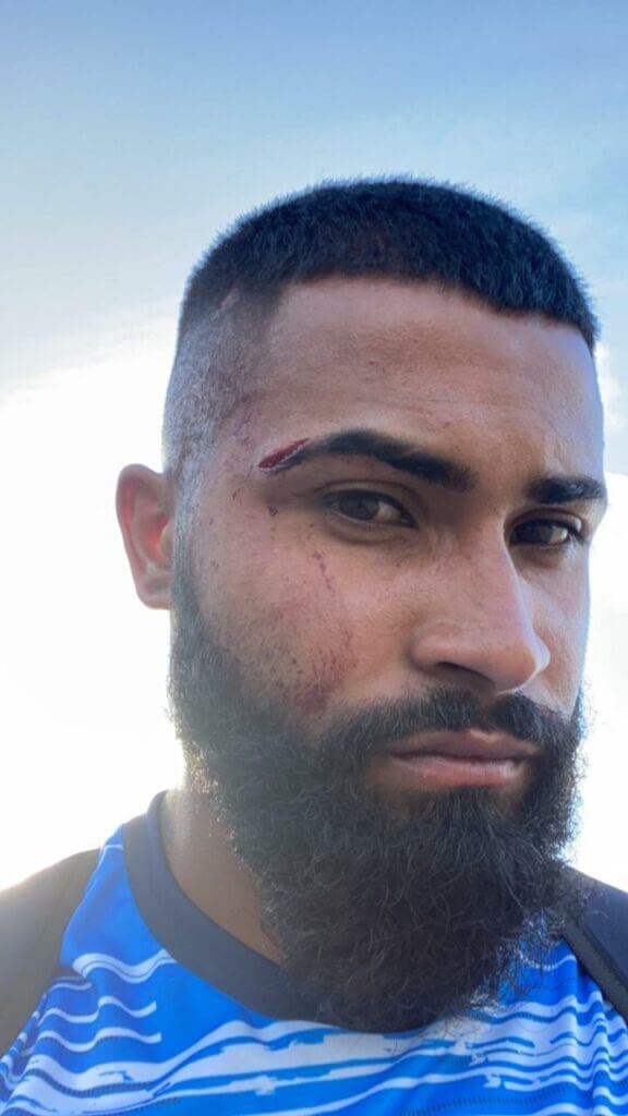 Confiança repudia agressão de “um grupo de vândalos”. Veja a nota oficial!