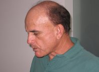 Série B: Oeste tem desfalques para não se aproximar da degola