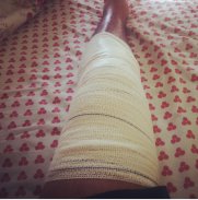 Série B: Após cirurgia, atacante do Figueirense torce por breve recuperação