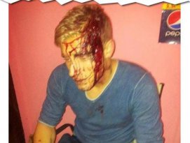 Violência! Atacante inglês leva machadadas em briga no bar