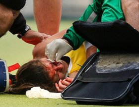 HÓQUEI: Brasileira leva bolada e vai ao hospital no Chile