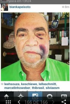 Presidente da Federação Catarinense é agredido em “jogo da marmelada”