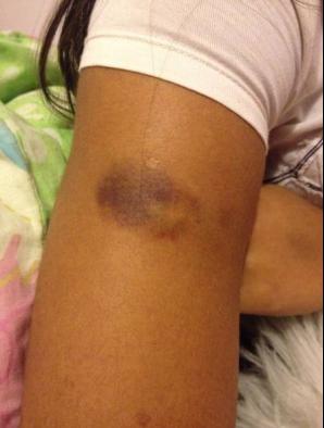 Marca da agressão - Reprodução