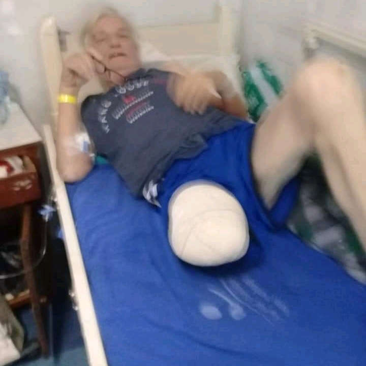 Juti teve a perna amputada Juti teve a perna amputada