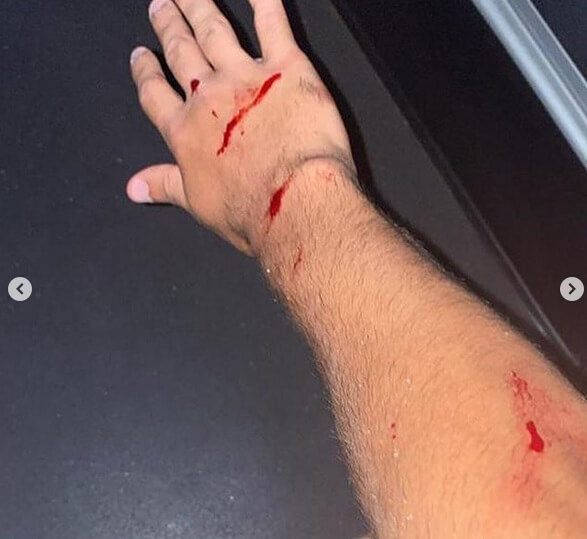 Vini Locatelli foi atingido por estilhaços de vidro após pedrada no ônibus