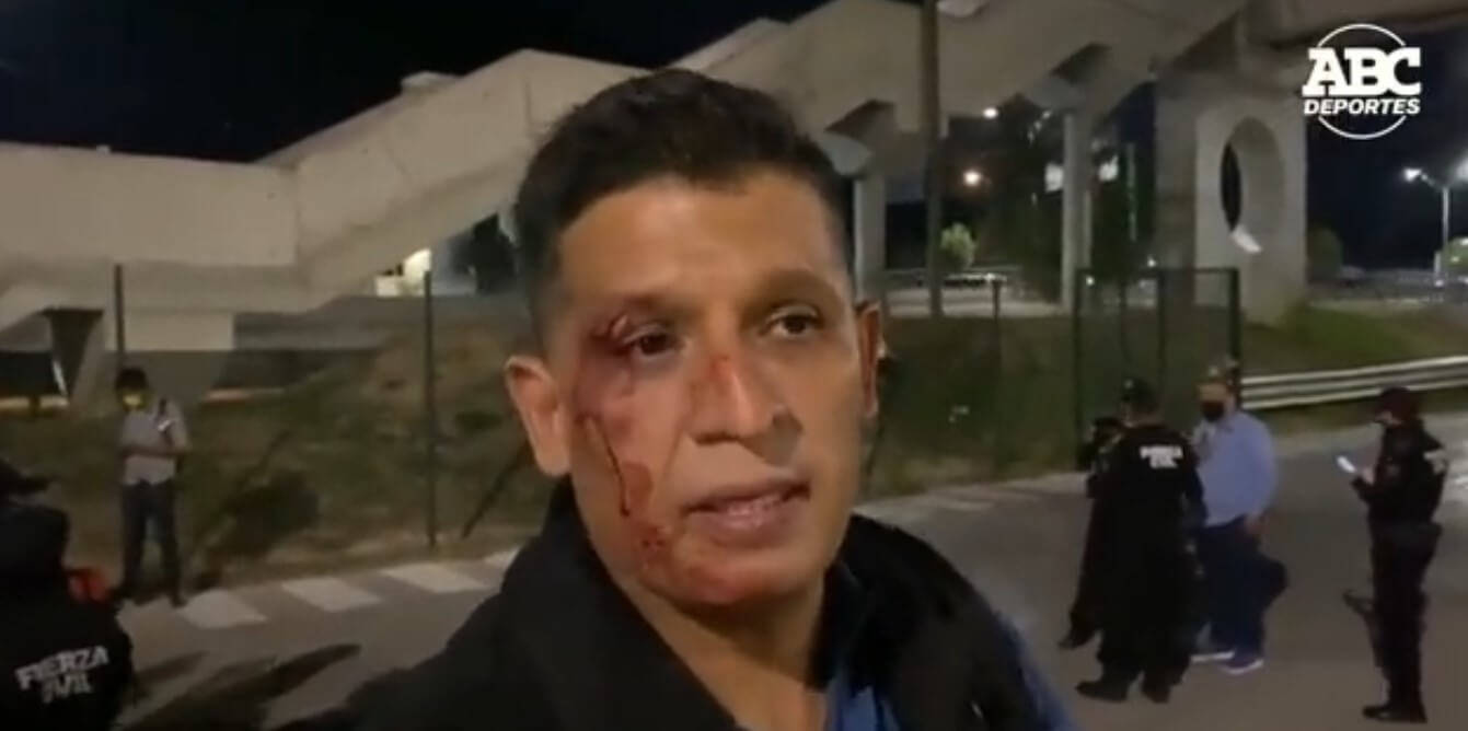 Sangue no rosto! Jornalista é agredido por torcedores na saída do estádio