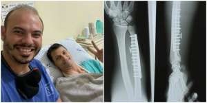 Série D: Goleiro passa por cirurgia após fraturar braço e para por dois meses