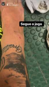 Arana posta foto com marca na perna cobrando pênalti ao Atlético-MG e é ironizado