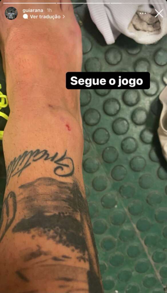 Arana posta foto com marca na perna cobrando pênalti ao Atlético-MG e é ironizado