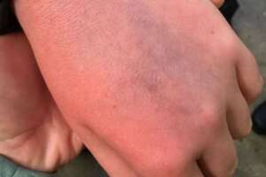 Inglês: Cristiano Ronaldo pede desculpas após agressão a jovem torcedor do Everton