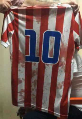 Camisa ensanguentada do torcedor atingido por pedrada