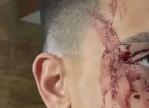 Jogador de time da Libertadores é agredido em assalto na Argentina