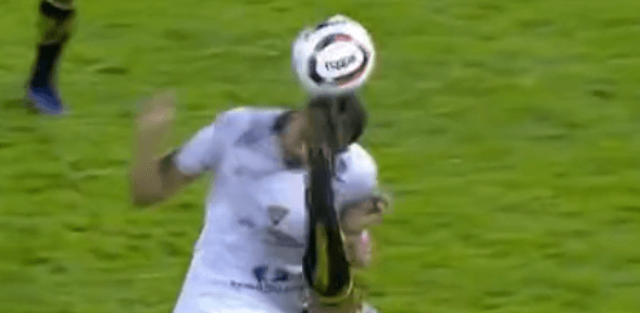 Joseph Tombense Novorizontino Fratura Testa