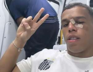 Paulistão: Sandry, do Santos, sofre fratura no nariz e passará por cirurgia
