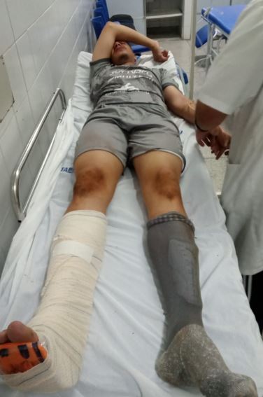 Paulista Sub-20: Goleiro do Guaçuano sofre fratura na perna em jogo contra Ponte Preta 2 jg