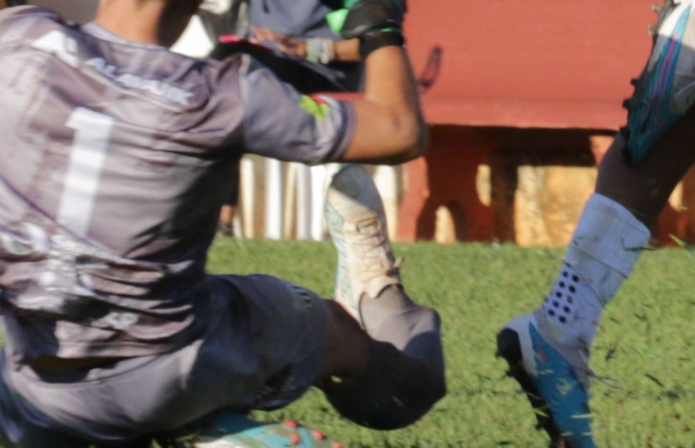 Goleiro do Guaçuano sofre fratura na perna