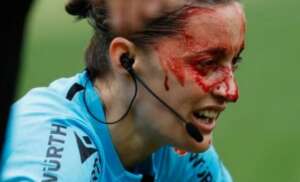 Colisão de árbitra assistente com câmera na Espanha choca mundo do futebol. Vídeo!