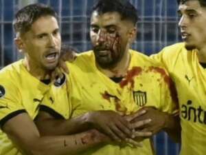 Jogador do Peñarol leva pedrada e deixa campo sangrando em jogo da Libertadores