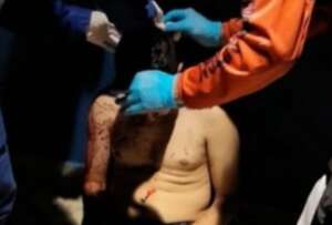 Torcedor da Ponte Preta é hospitalizado após agressão em Manaus
