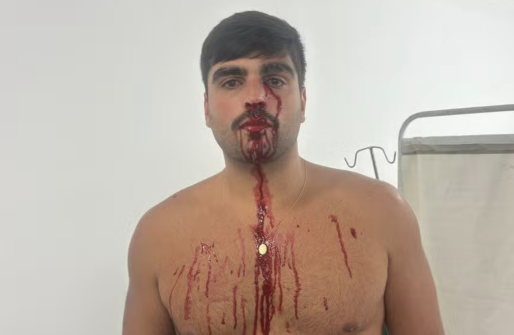 Torcedor processa Flamengo após ser atingido por fogos de artifício no Maracanã