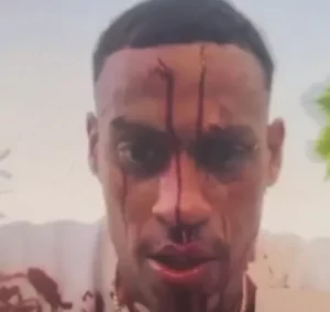 Atacante do Coritiba aparece ensaguentado após briga em festa