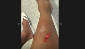 Memphis posta perna machucada em pênalti e deve ser desfalque no Corinthians