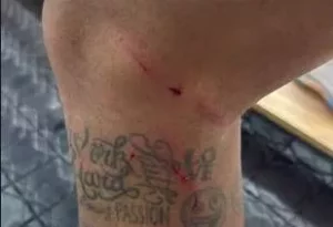 Neymar mostra perna e ironiza arbitragem: 'Podem virar longos 10 meses'