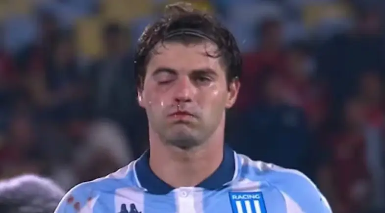 Craque do Racing fratura maxilar e deve ser desfalque contra o Flamengo na Libertadores