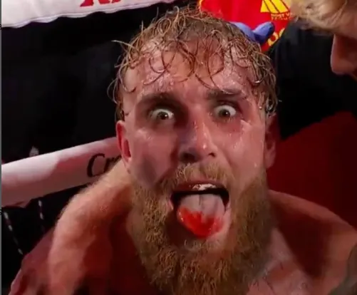 Jake Paul sofre fratura em luta de boxe