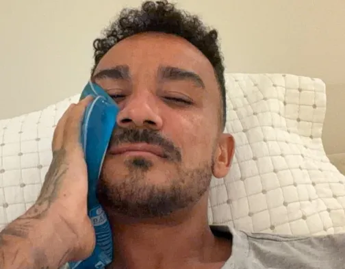 Lateral do Flamengo brinca após cirurgia no rosto: 'Cheio de parafuso'
